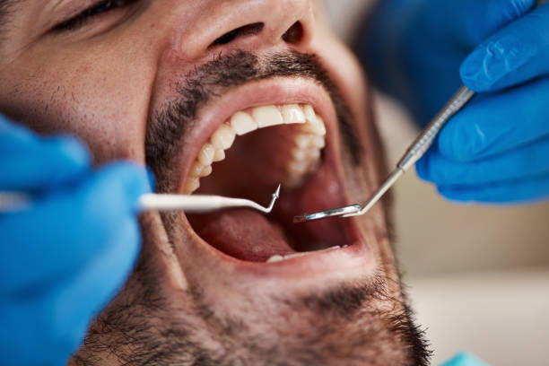 Tooth Infection Emergency Dentist in NY